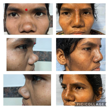 Slider image (2) Konarc Aesthetics - Plastic & Cosmetic Surgery In Gurgaon, India.